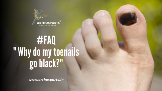 Why do my toenails ggo black | Orthosports Physiotherapy by Dr. Rajani Patil